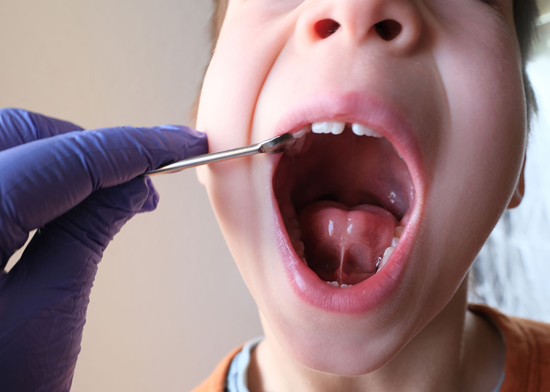 Greater Lansing Tongue Tie Pediatric Dentists